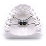 palatal expander model